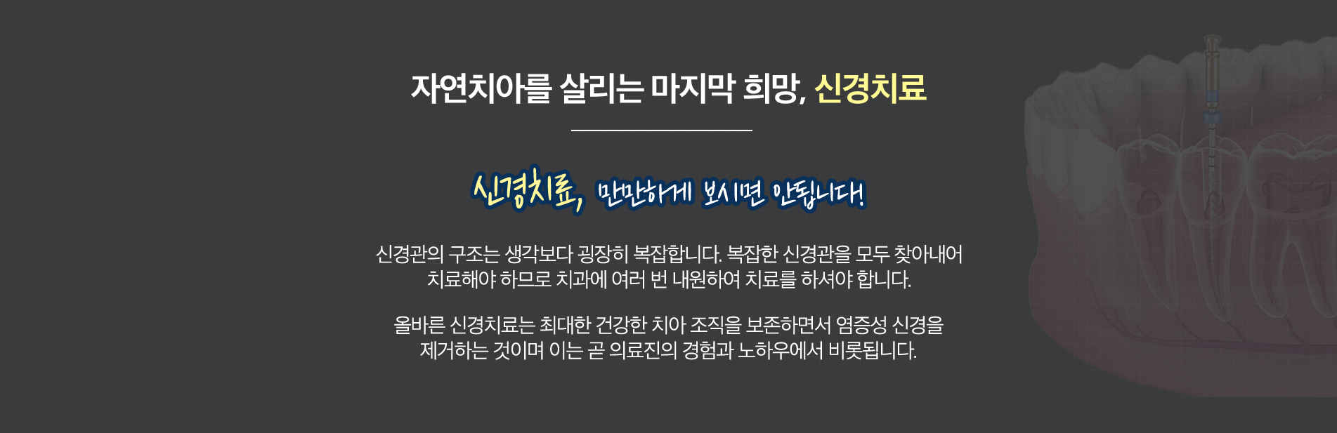 신경치료