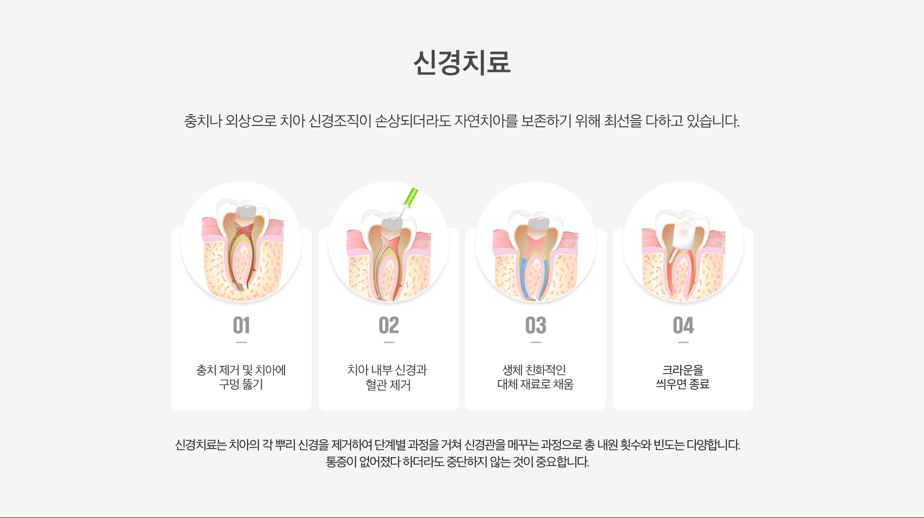 신경치료