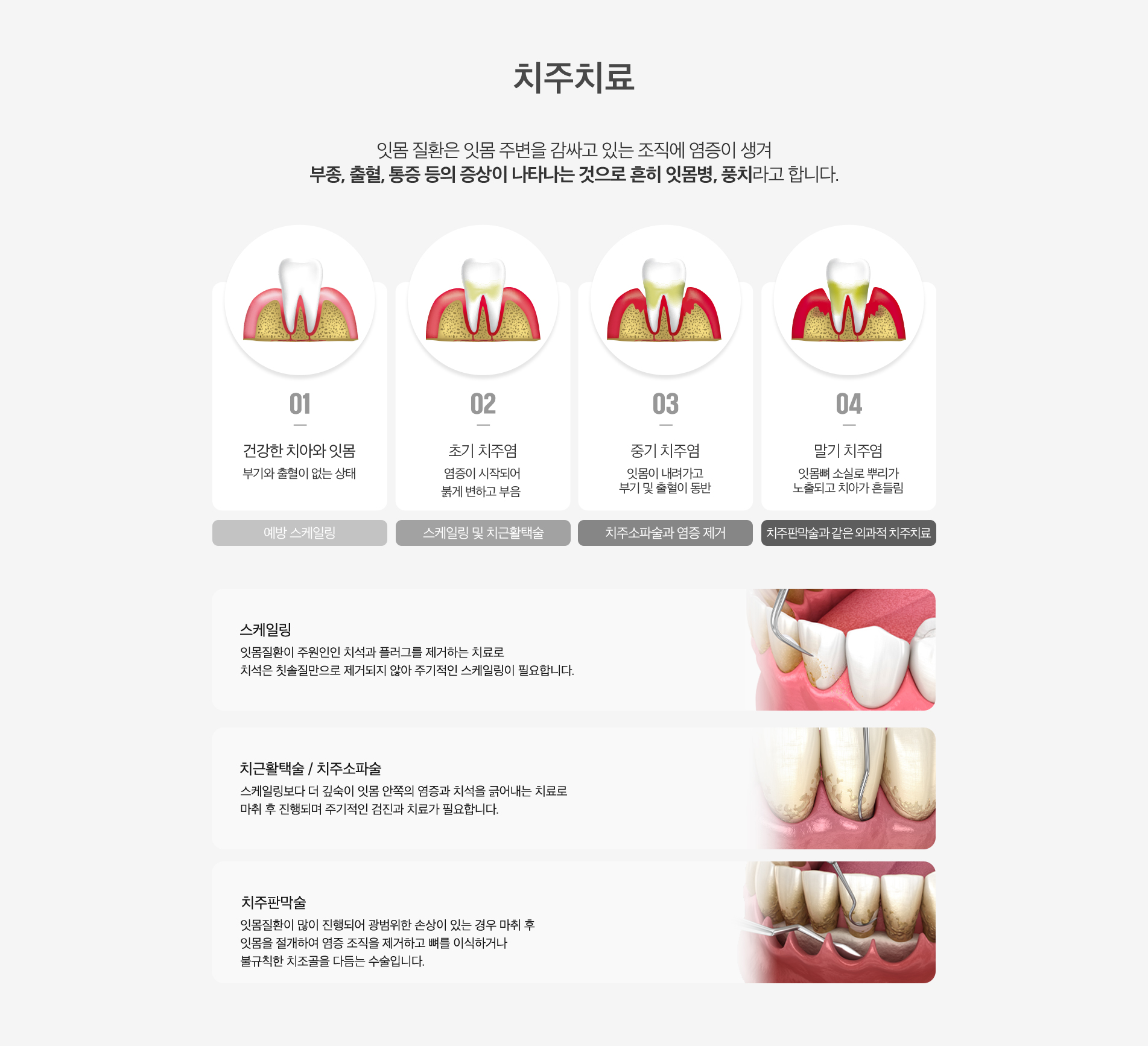 치주치료