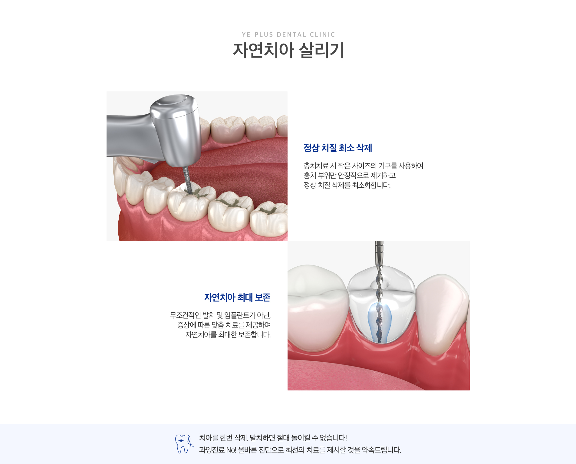 자연치아살리기