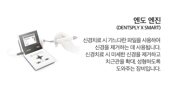 엔도엔진
