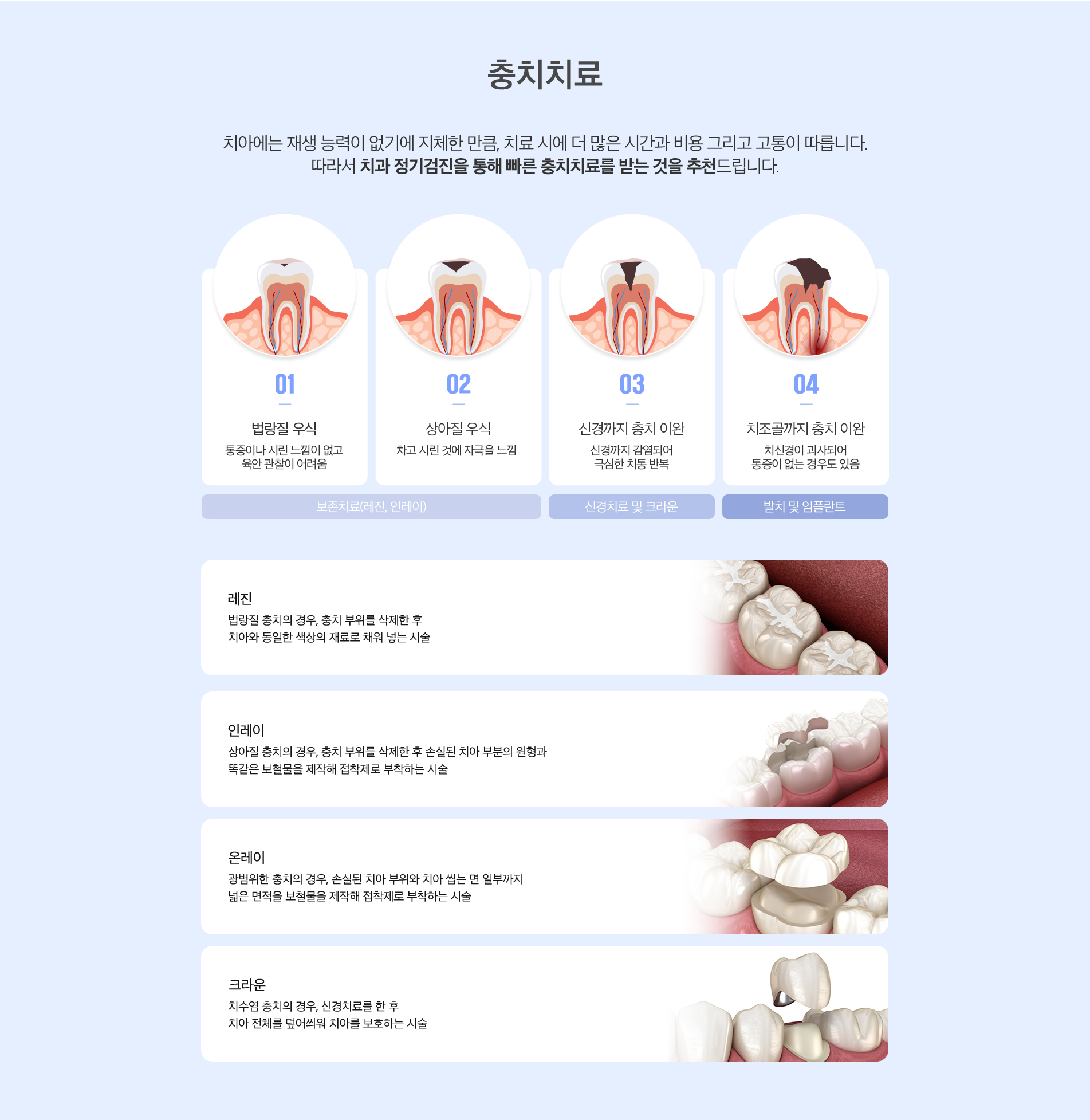 충치치료