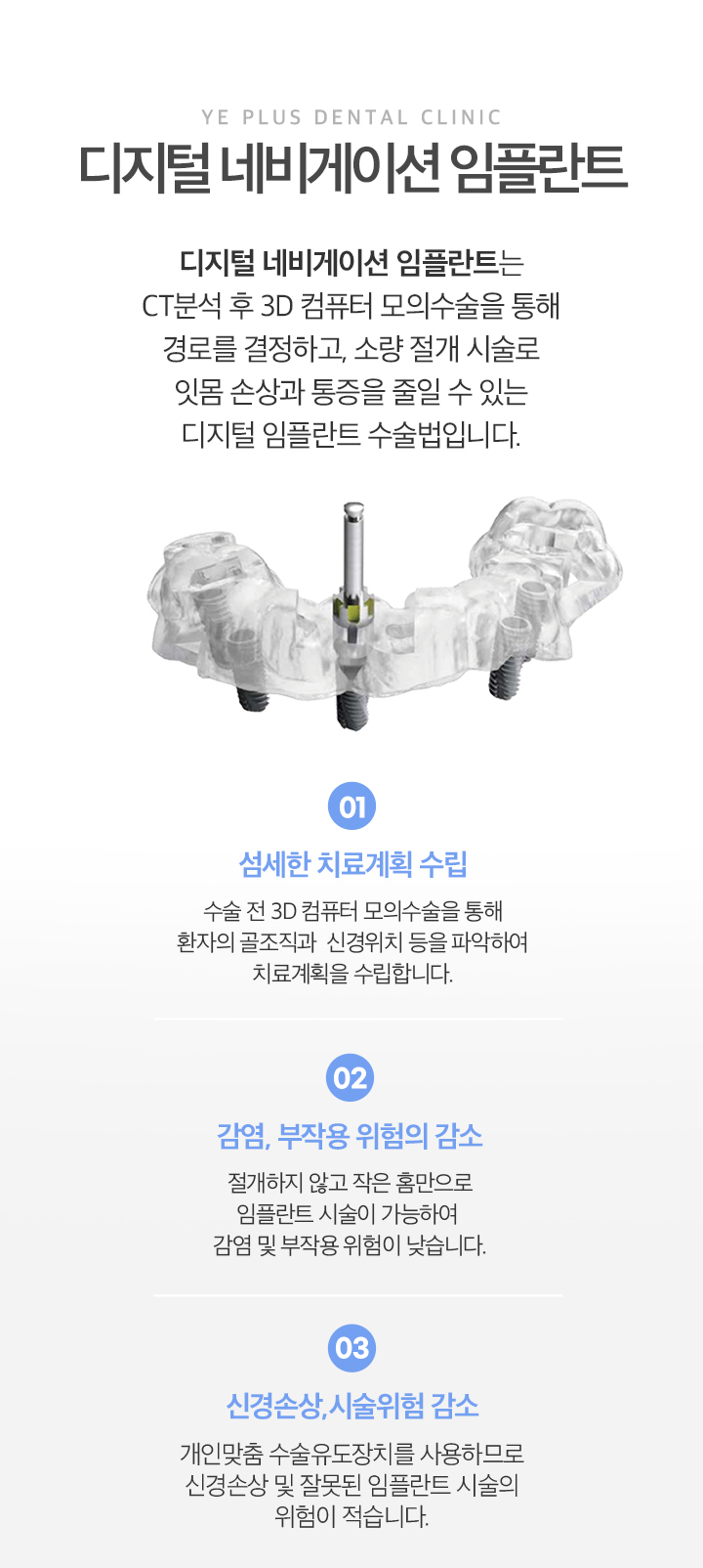 디지털 임플란트