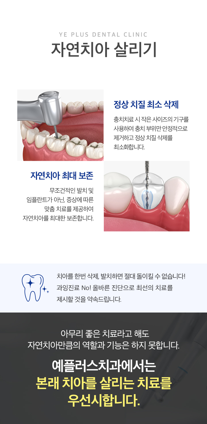 자연치아 살리기