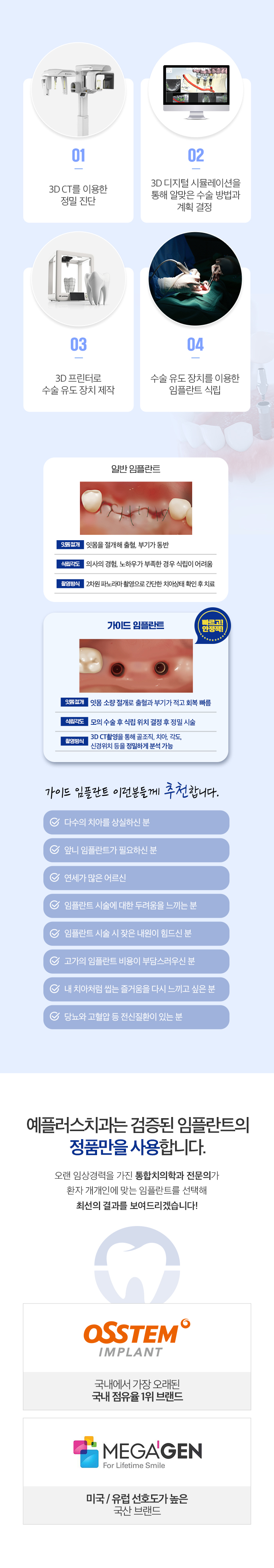 디지털 임플란트