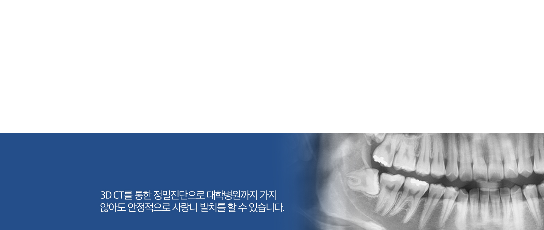 사랑니발치