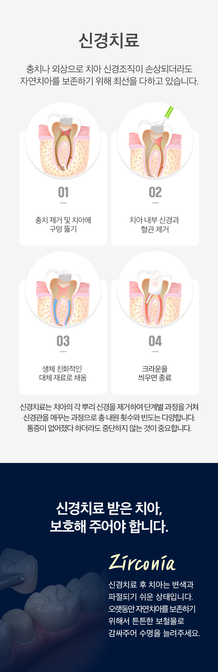 신경치료02