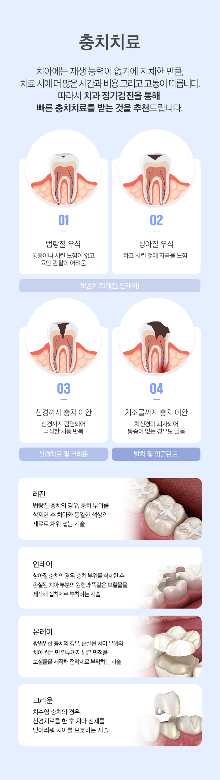 충치치료